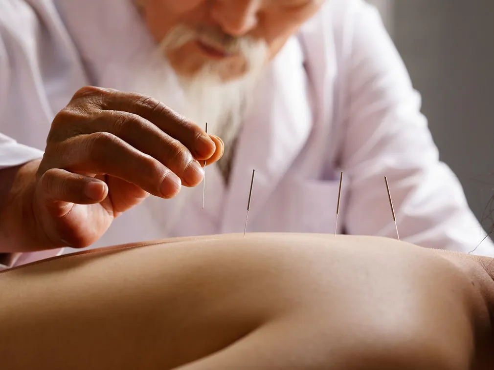 calgary-college-traditional-chinese-medicine-acupuncture
